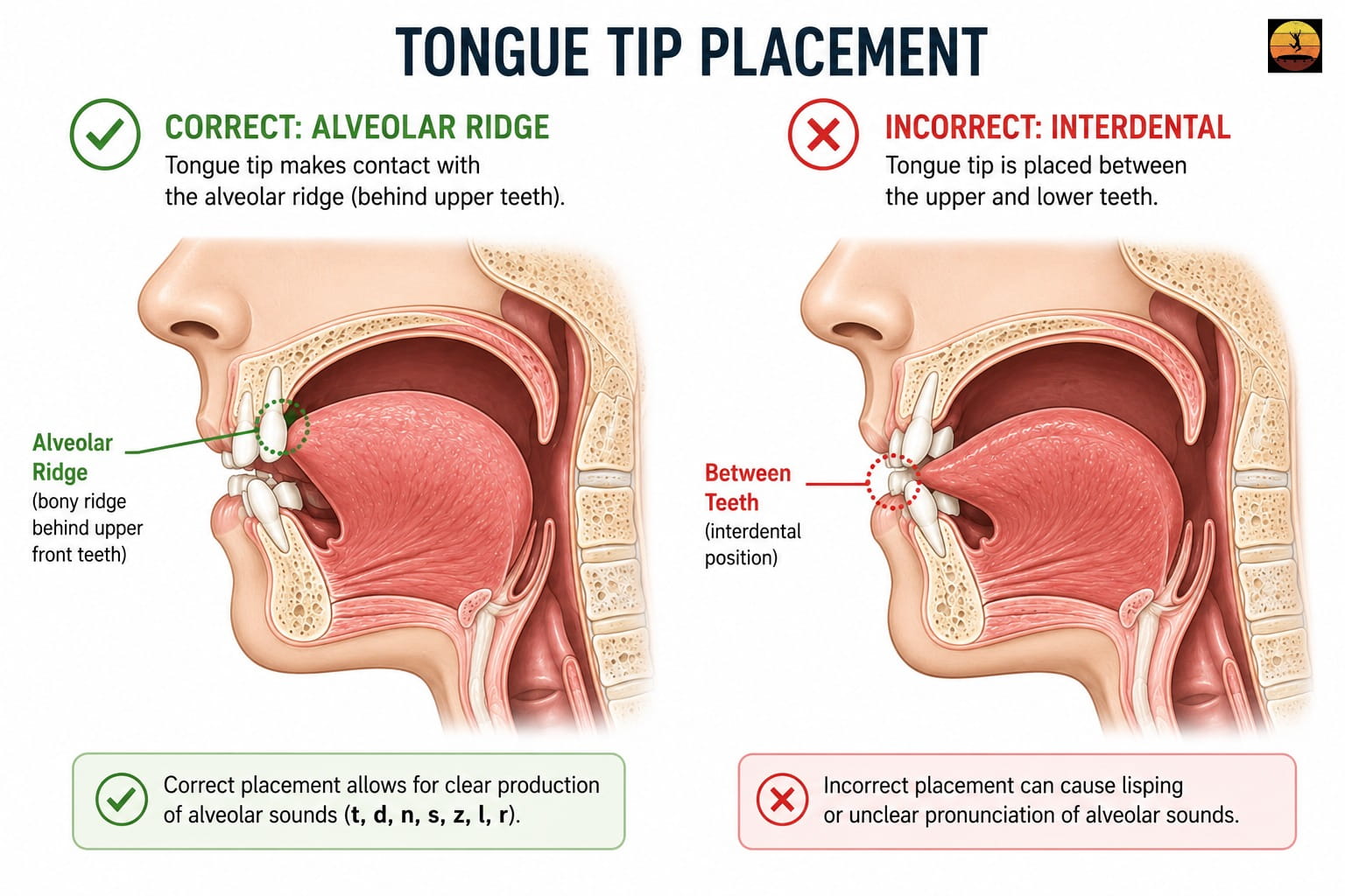 Infographic showing a quick airflow test to identify different types of lisps.